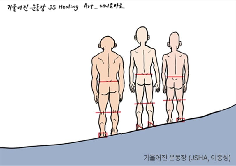 기울어진 운동장 그림 — 기울어진 지면 위에 서면 발·골반·척추 정렬이 함께 틀어진다